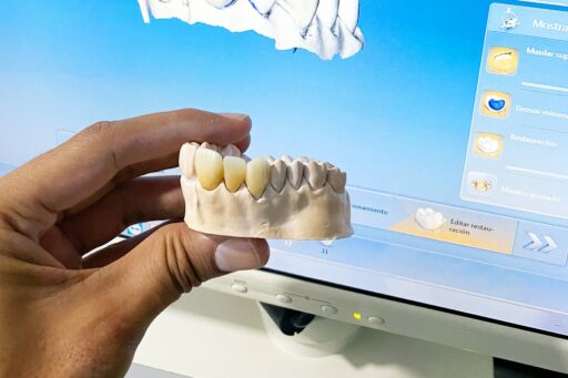 Smile design process